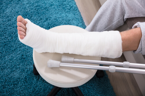 broken bone