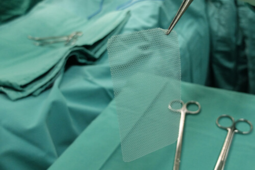 hernia mesh